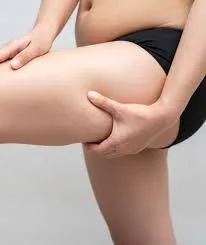 How to Reduce Thigh Fat